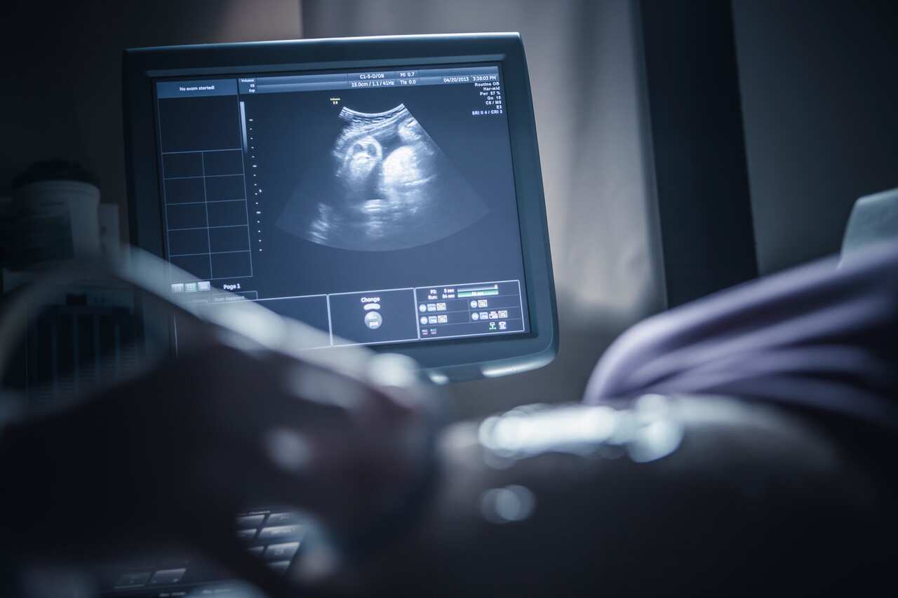 A hand can be seen holding an instrument to a woman's belly, with a screen showing the ultrasound in the background.