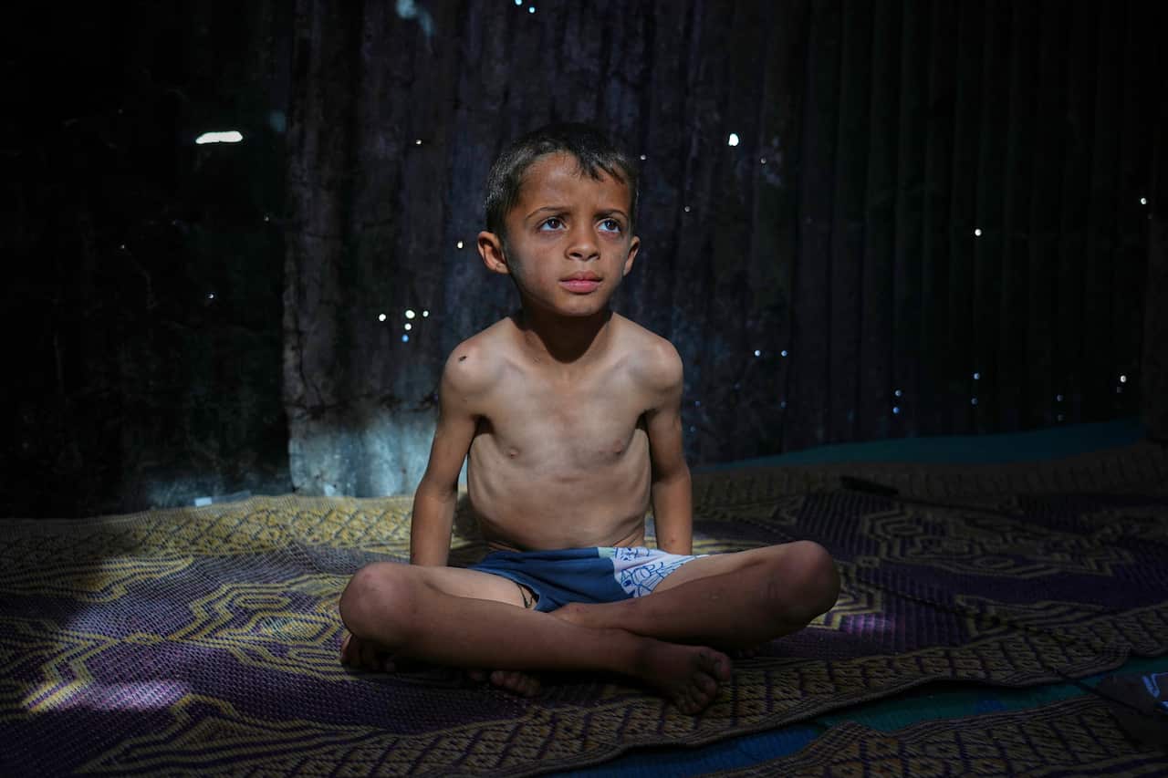 A young malnourished boy sits on a blanket