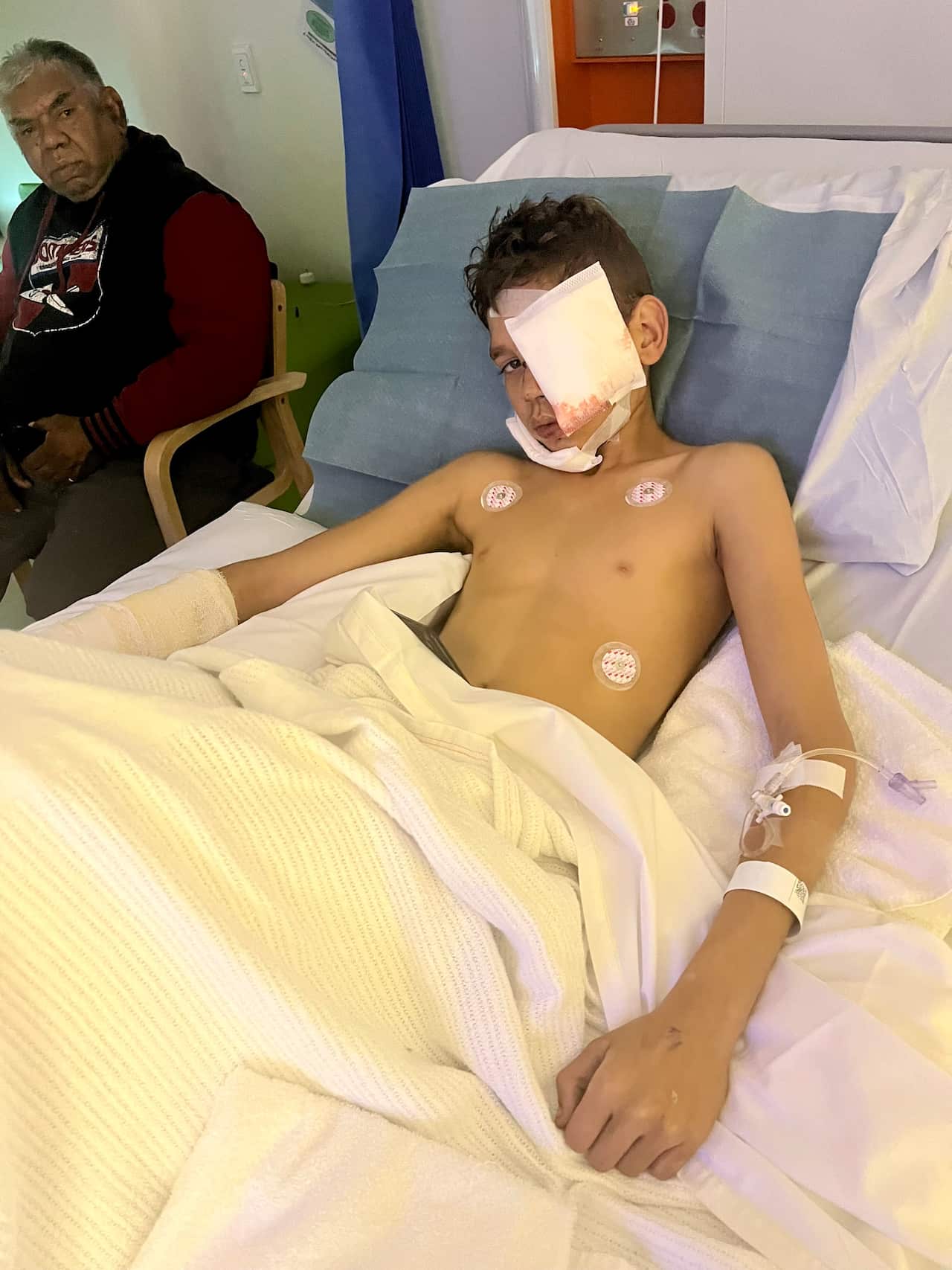 a young boy lies in a hospital bed with face bandages and a cast on his right arm while an older man looks on