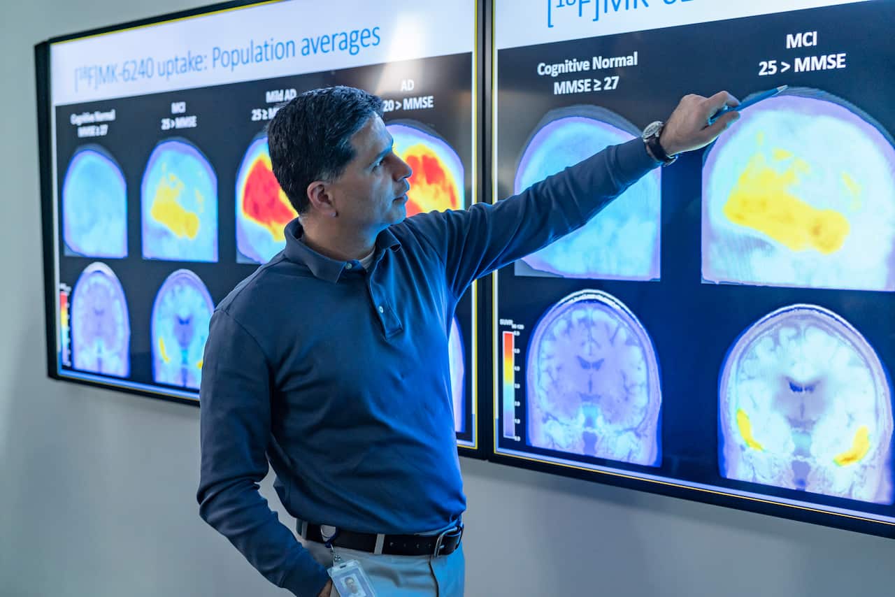 A man points to multicoloured brain scans.