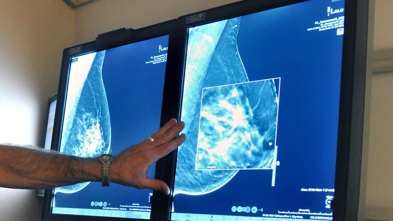 A new report finds some radiologists over-service terminally ill cancer pateiens.