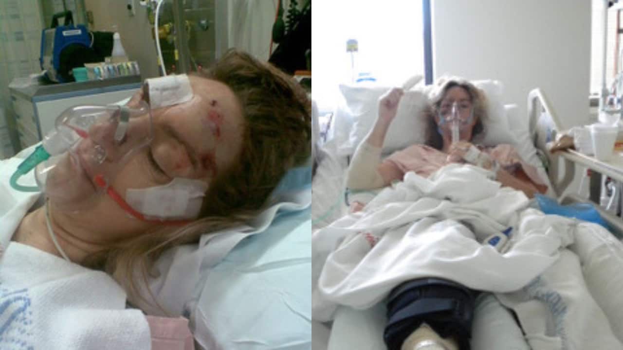 a side-by-side image of a woman with an oxygen mask on, bloody cuts and bandages on her face lying unconscious on a hospital bed. the other image is of the same woman awake in the hospital bed with her arm raised.