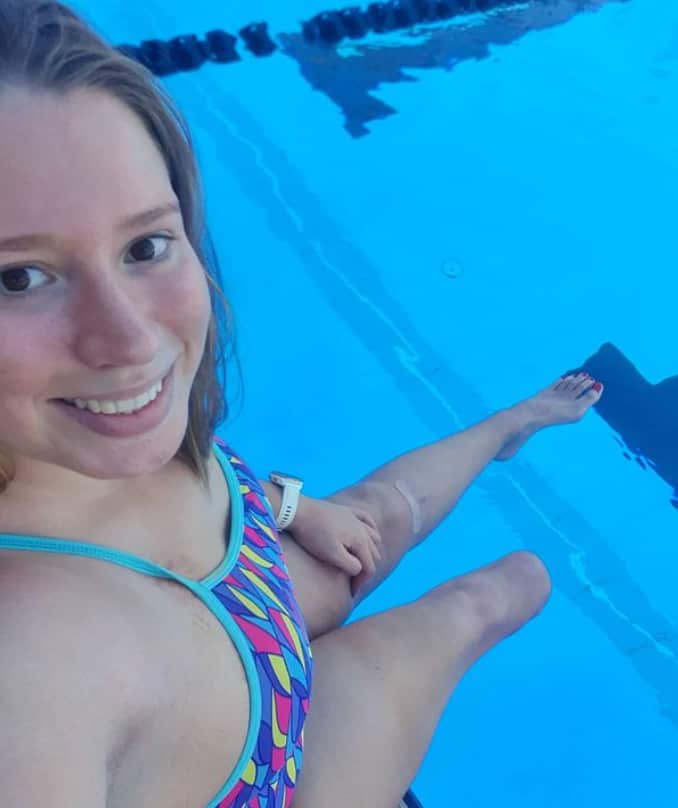 A woman in a one-piece swimsuit sitting at the edge of a pool. Part of her right leg is missing.