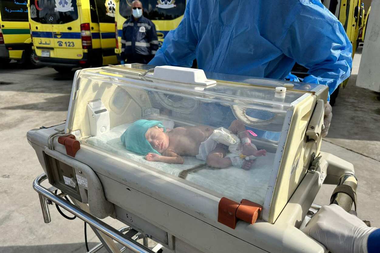 A baby in an incubator