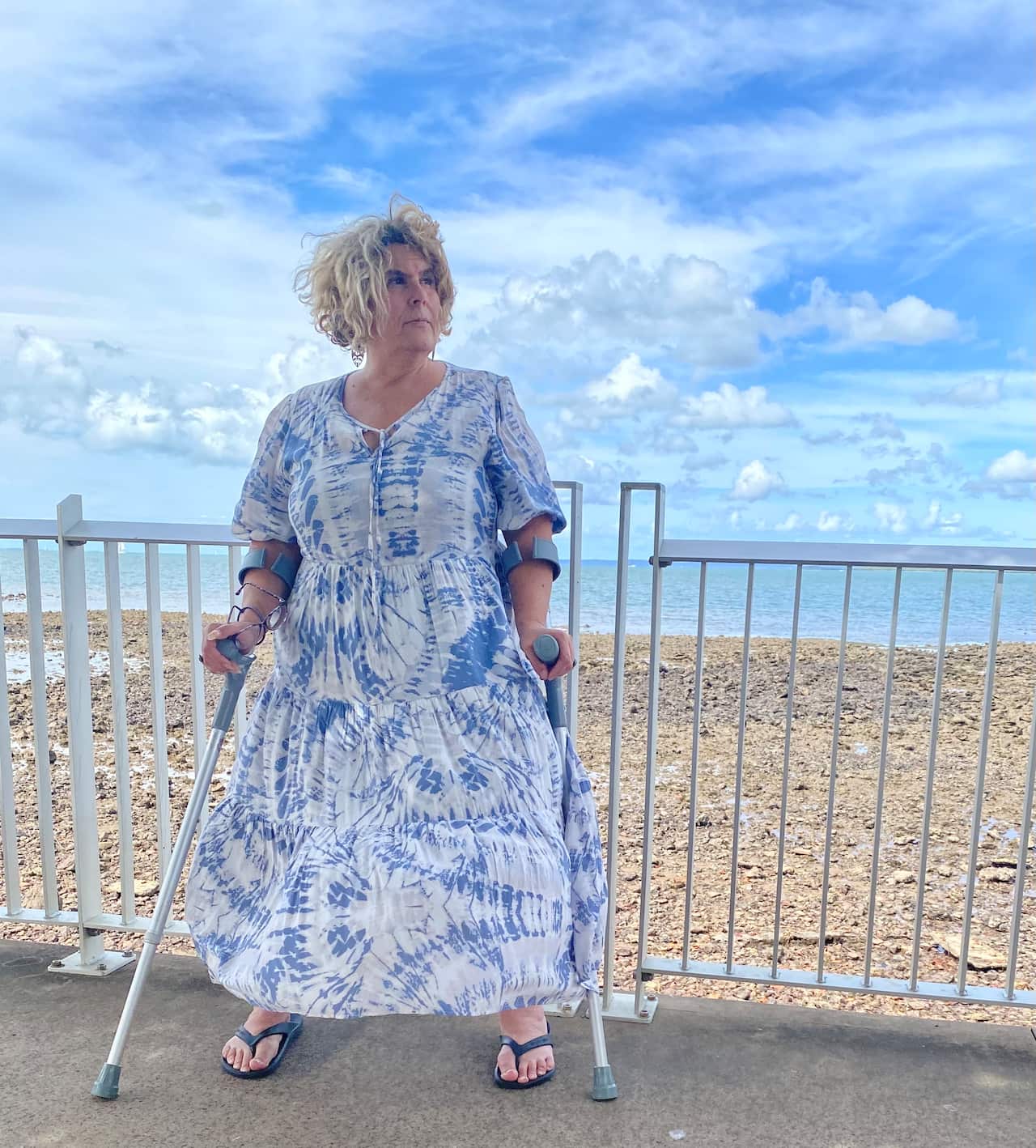 A woman using crutches stands on the footpath by the beach. She's wearing a billowy blue and white dress.
