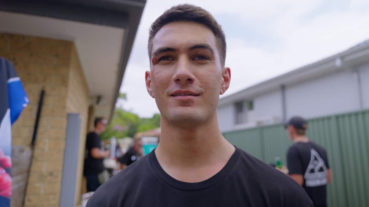 A close-up of a man wearing a black t-shirt and with a small cut above his right eye in a backyard