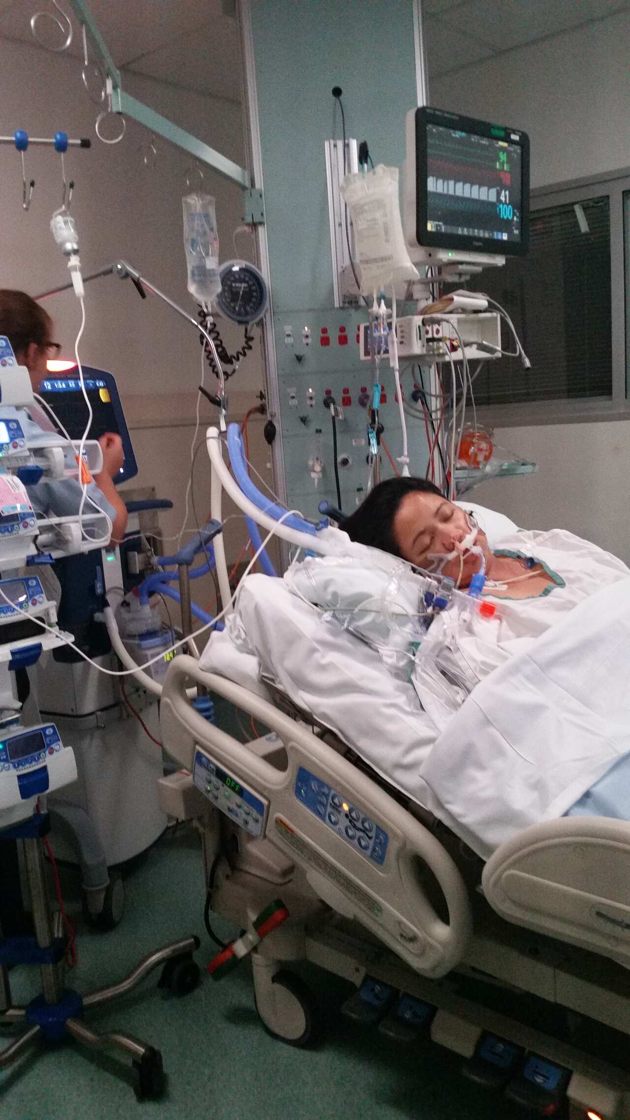 A woman lying in a coma in a hospital bed.