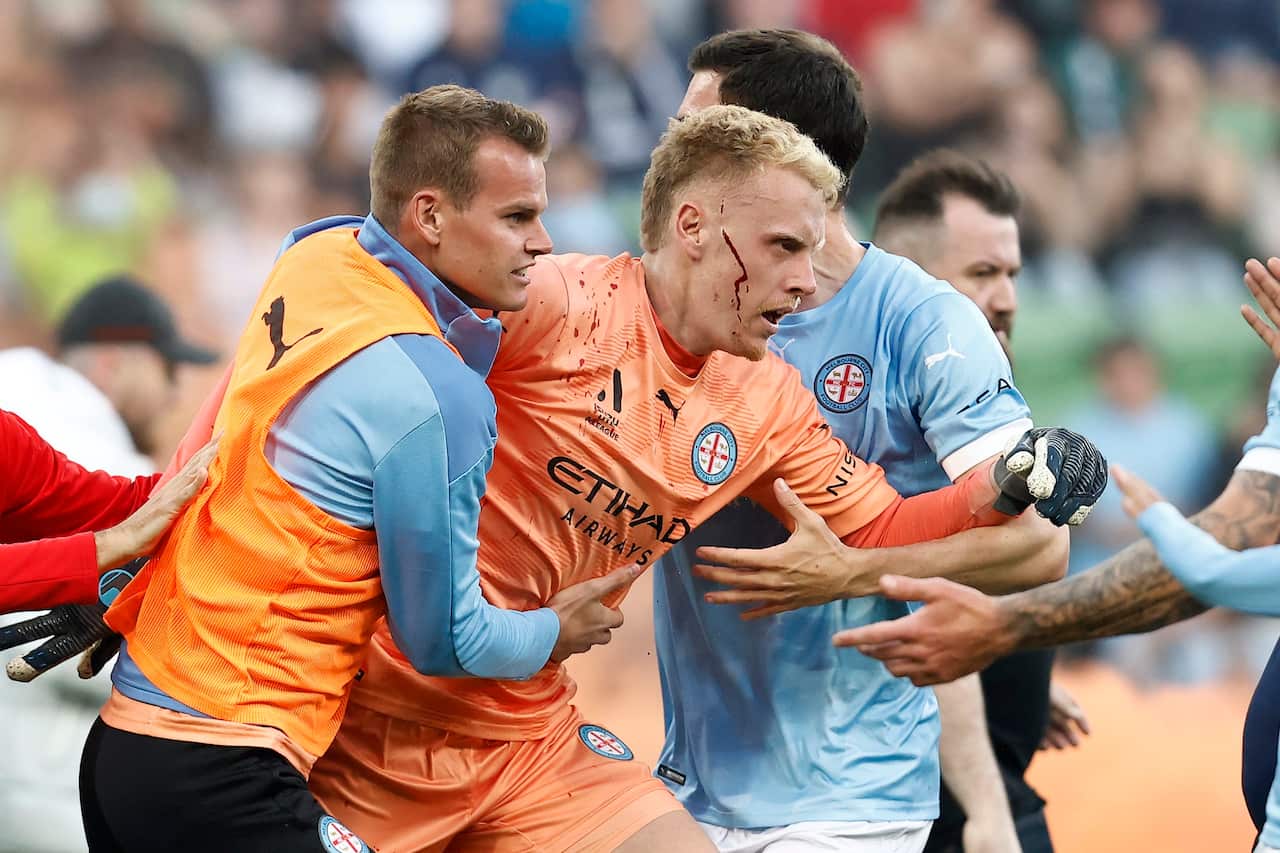 A bleeding Tom Glover of Melbourne City is escorted from the pitch after being hit with a garbage can.