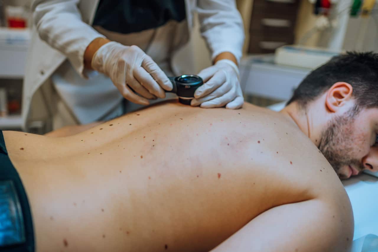 Australia Explained: Sunscreen