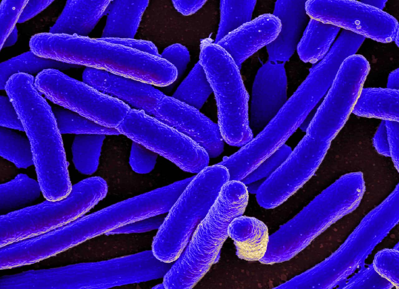 E. coli bacteria under a microscope. They look like short blue worms