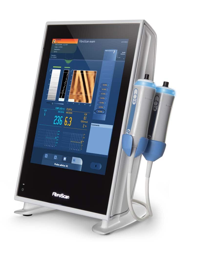 FibroScan®_530_Compact(1).jpg