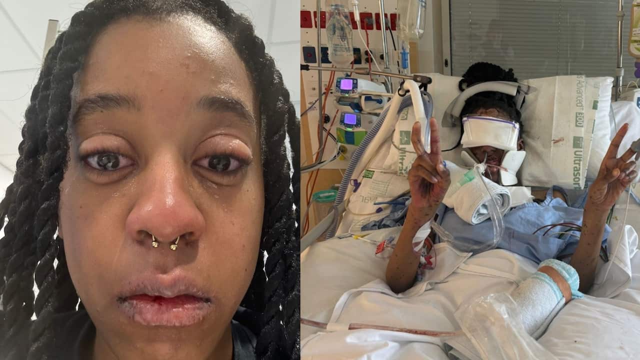 a side by side image of a young woman looking distressed (left) and the same young woman in a hospital bed hooked up to tubes (right)