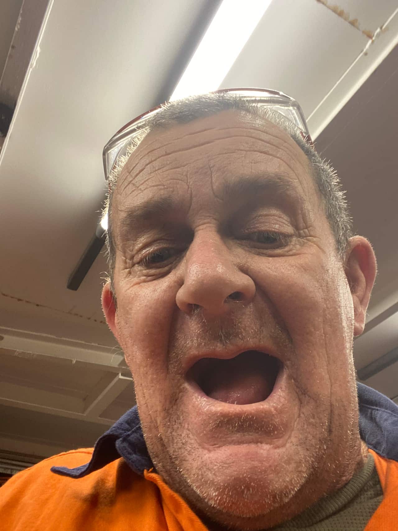 A close-up of a middle-aged white man with his mouth open, showing he has no teeth. 