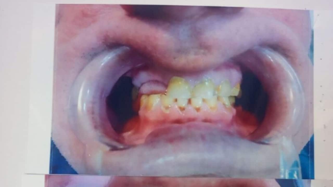 a closeup shot of a mouth in a dental surgery, with yellow teeth