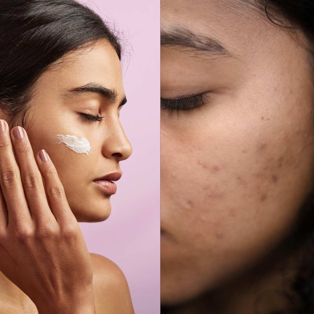 skincare concerns.png