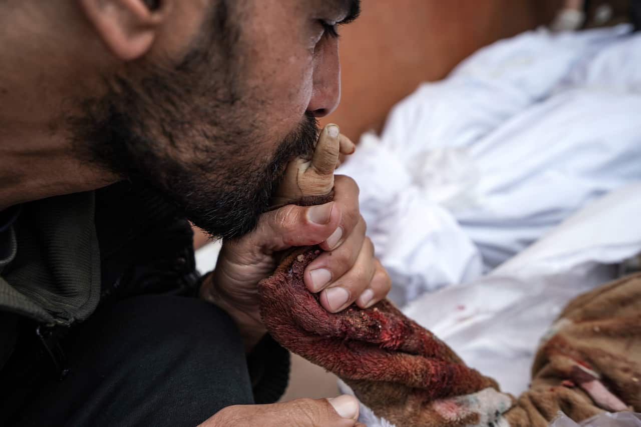A man kisses the hand of his dead child in Gaza