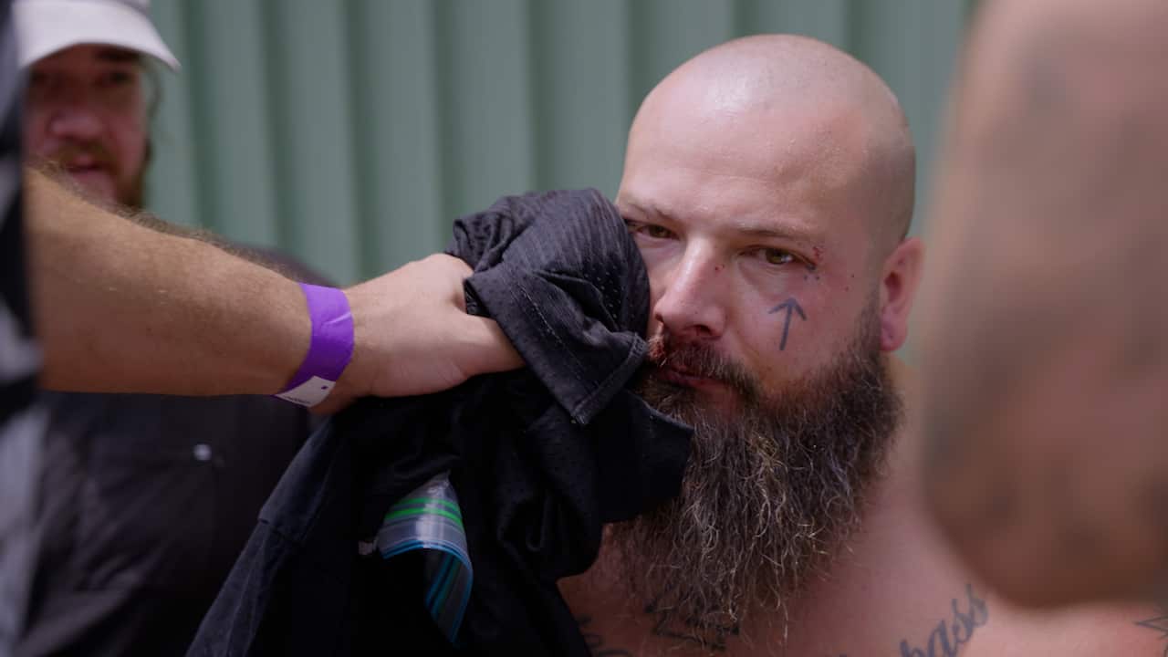 A man with a long beard has an ice pack held to his right cheek.