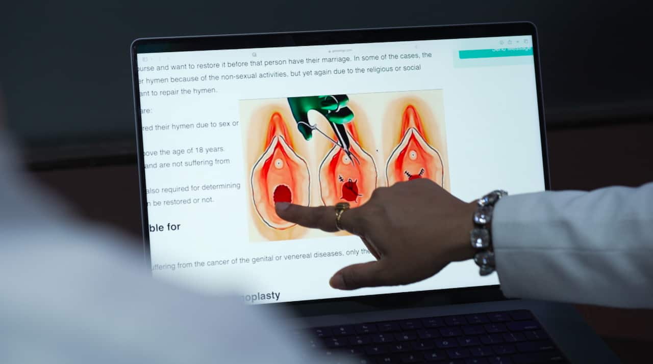 A woman's hand points to a laptop screen, which shows a diagram of hymenoplasty. 