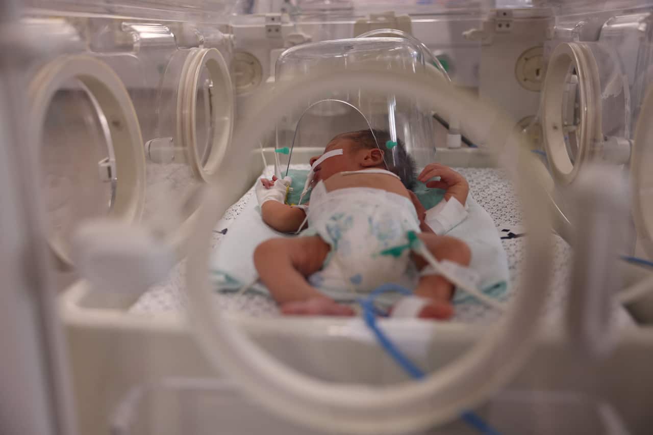 A baby lies in an incubator.