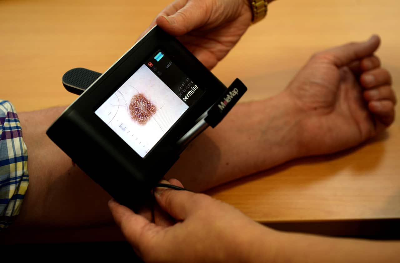 A patient being checked for skin cancers at a skin cancer clinic.