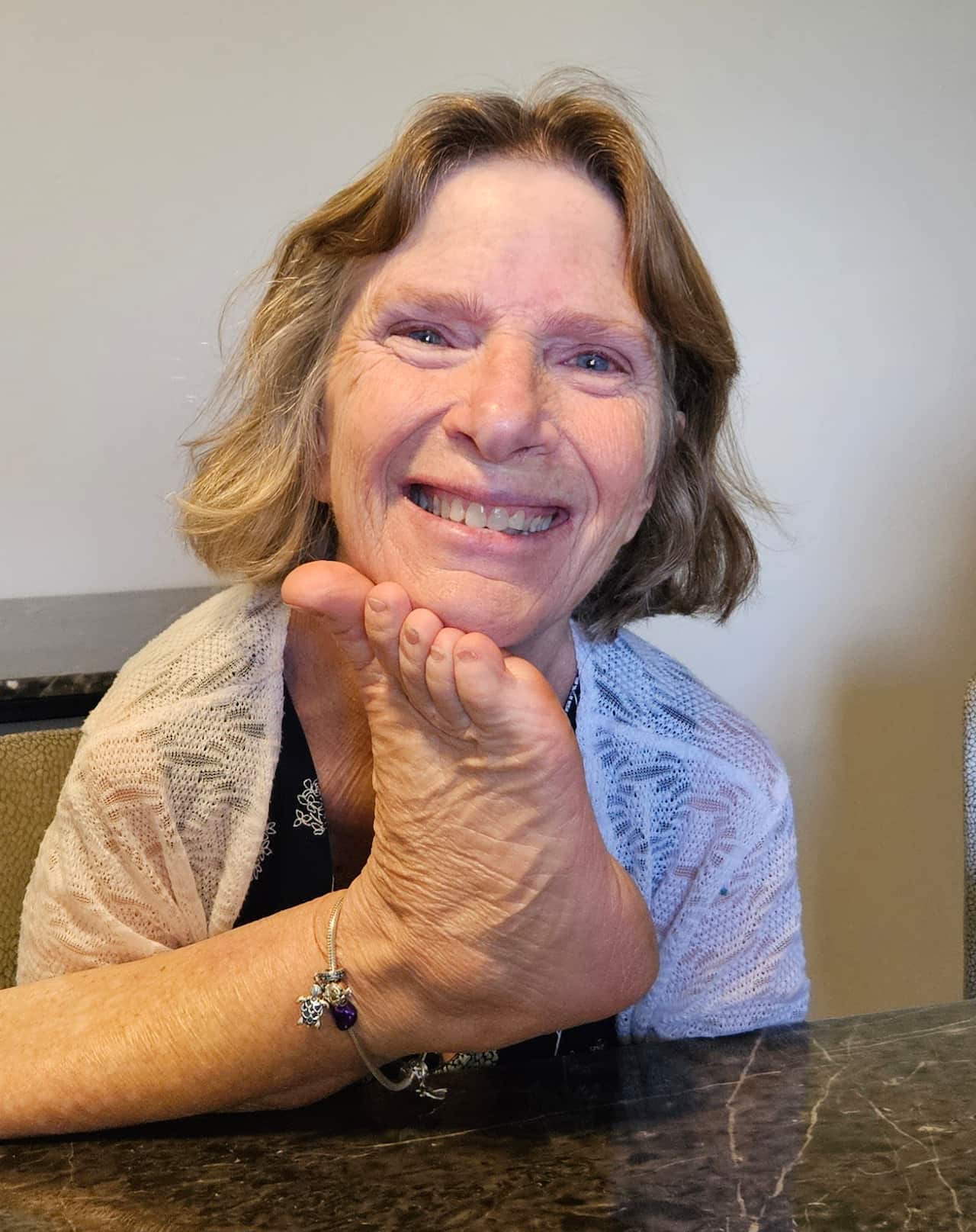 Thalidomide survivor Trish Jackson 