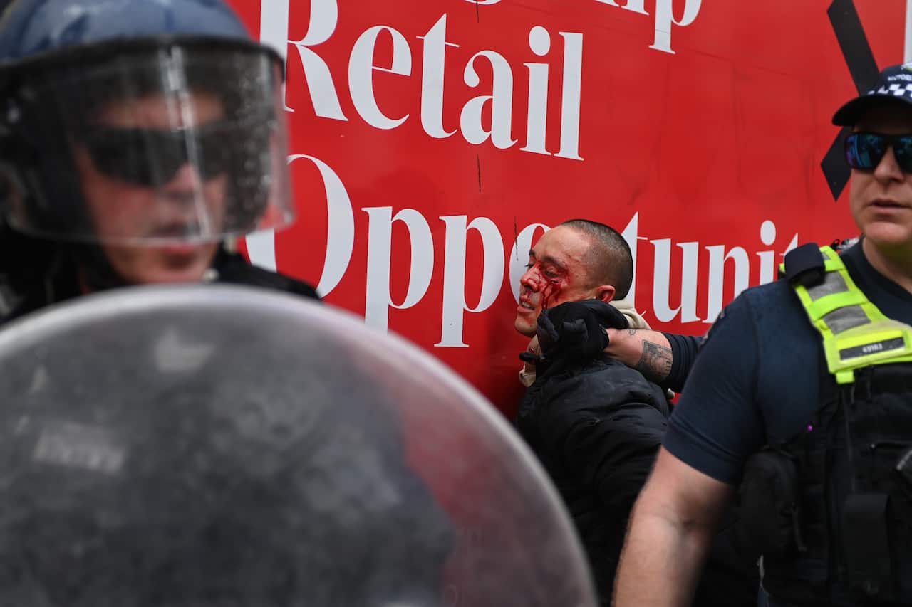 ANTI IMMIGRATION PROTEST 