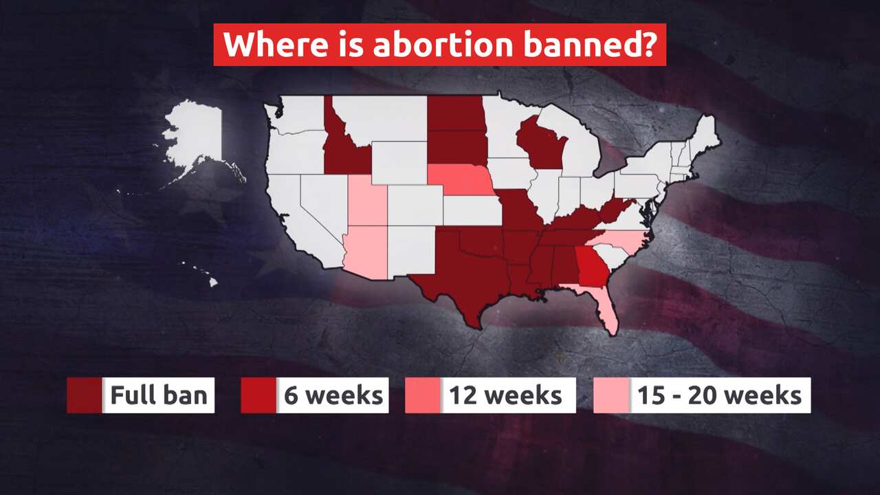 Map showing where abortion is banned in the United States.