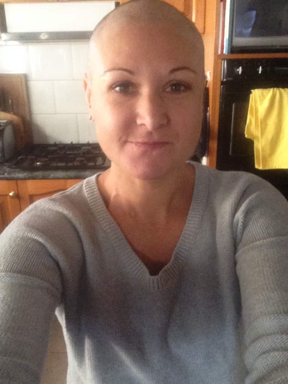 A selfie of a woman who has lost her hair.