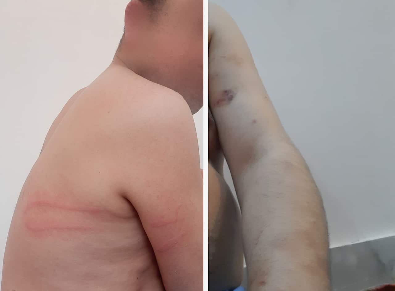 Torture pics blurred final.png