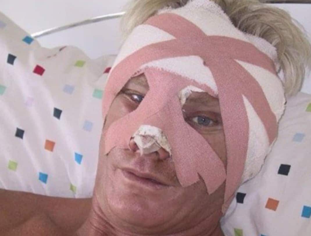 a man with a bandaged face 