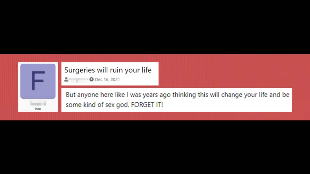 A post on a looksmaxxing forum where a user expresses regret after getting plastic surgery