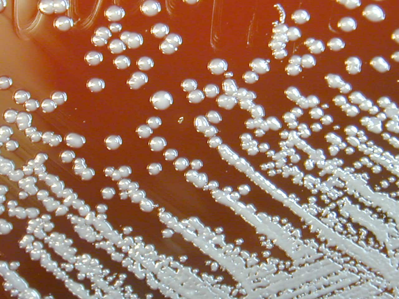 A white, droplet-shaped bacterium in muddy water.