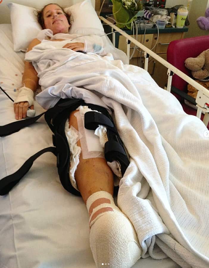 A women in a hospital bed with her leg bandaged up.