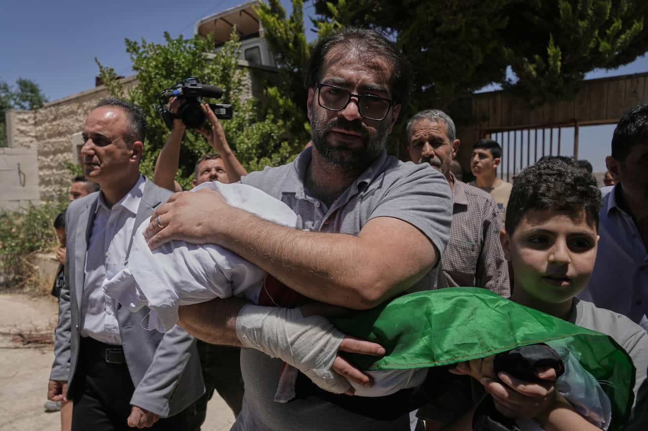 APTOPIX Israel Palestinians West Bank Baby Killed