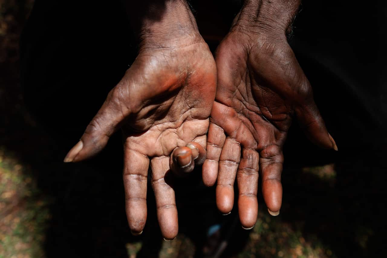 JALNGANGURRU HEALING