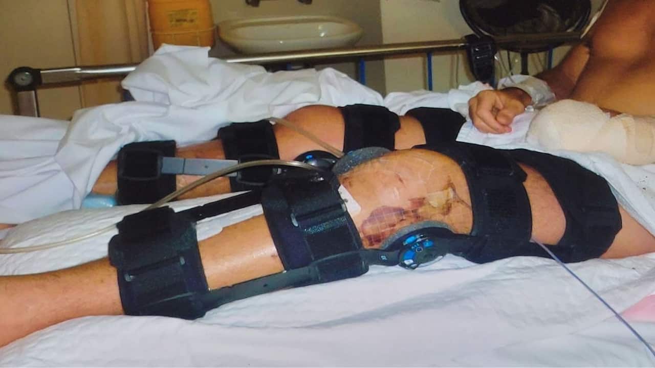 a man's injured legs in braces in a hospital bed