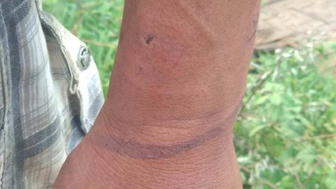 ဖမ်းဆီးခံရာမှ ပြန်လွတ်မြောက်လာသူ