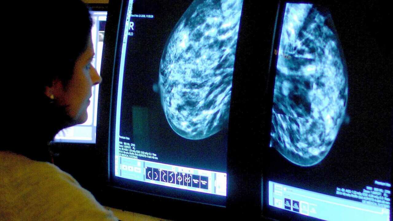 mamogram
