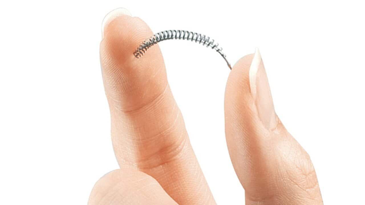 This image provided by Bayer Healthcare Pharmaceuticals shows the birth control implant Essure.