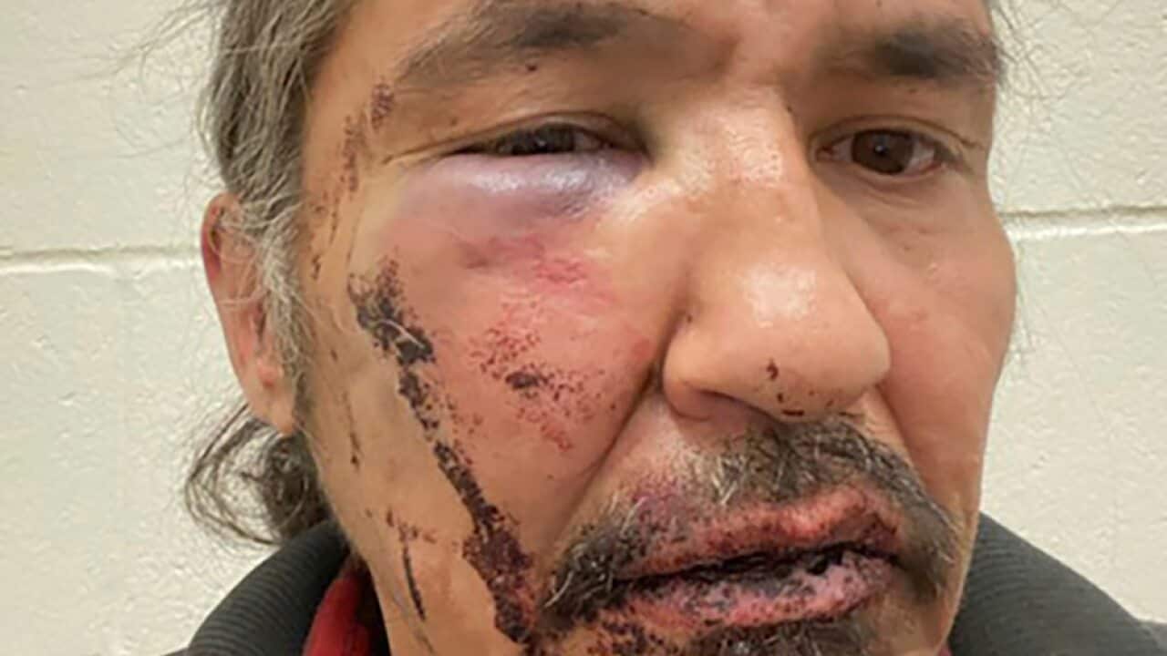 Athabasca Chipewayan Chief Allan Adam is calling for the government to investigate after he alleges RCMP assaulted him during an arrest.