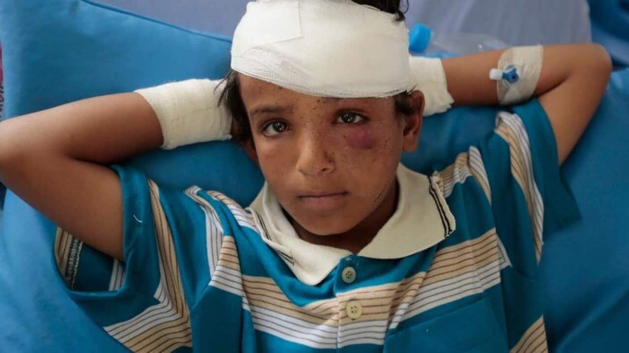 A child injured in a deadly Saudi-led coalition airstrike in Yemen.