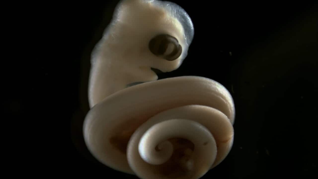 An embryo of an African house snake showing right-handed coiling.jpg