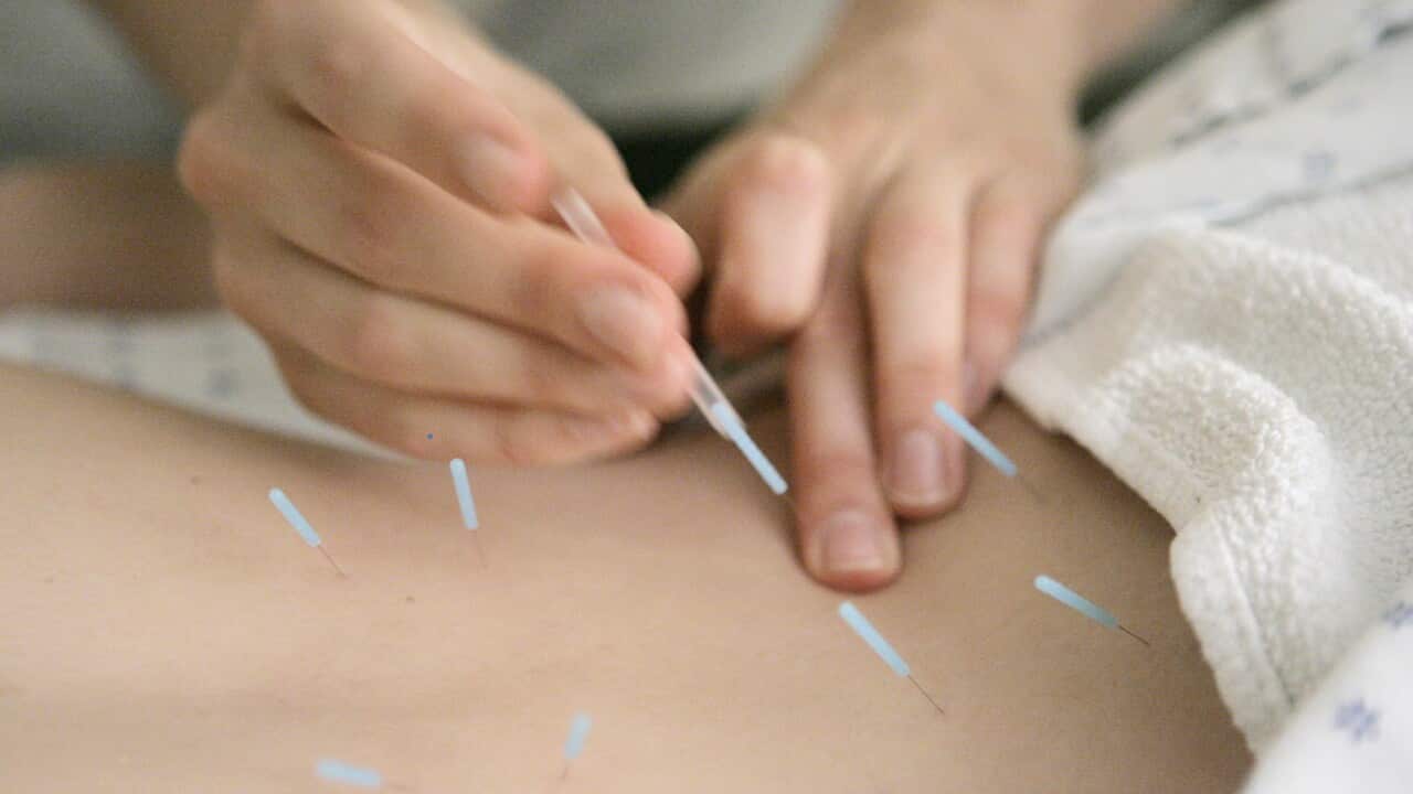 acupuncture.
