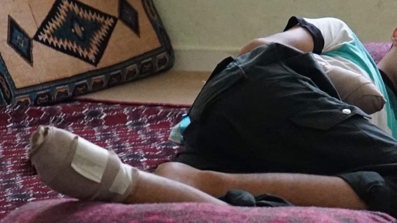 'Omar' had his hand and foot cut off as punishment for refusing to join IS.
