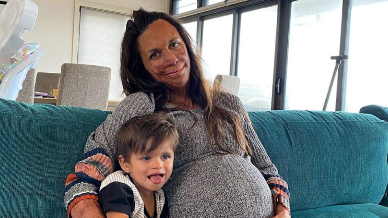 Turia Pitt