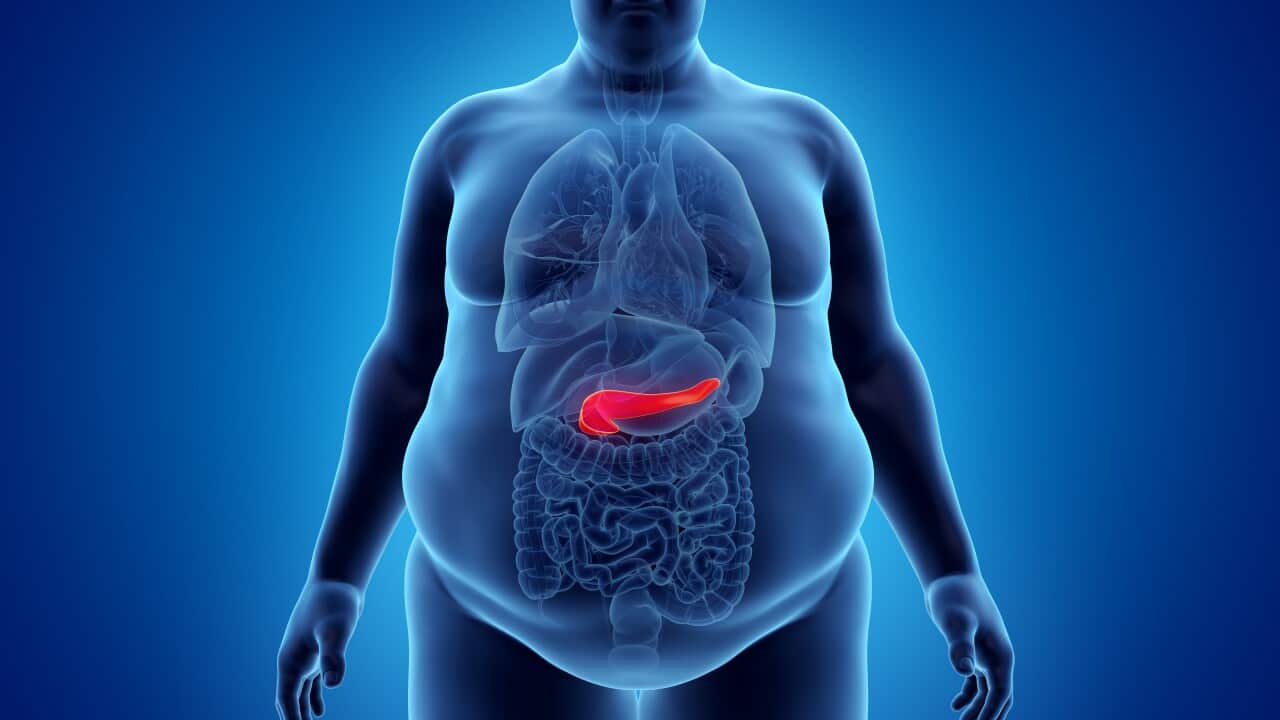 Obese man's pancreas, illustration