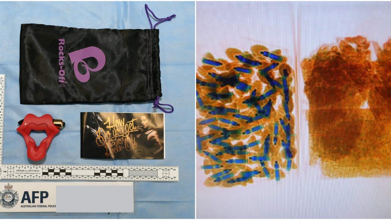 An X-ray of the illicit drugs found by the ABF.