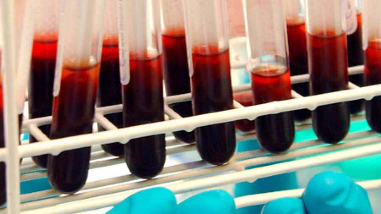doping_blood_test_100527_B_aap_2140285030