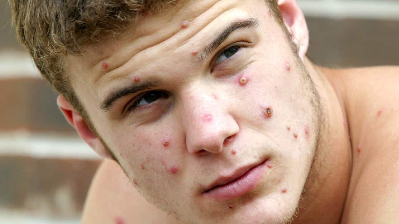 Image for read more article ''