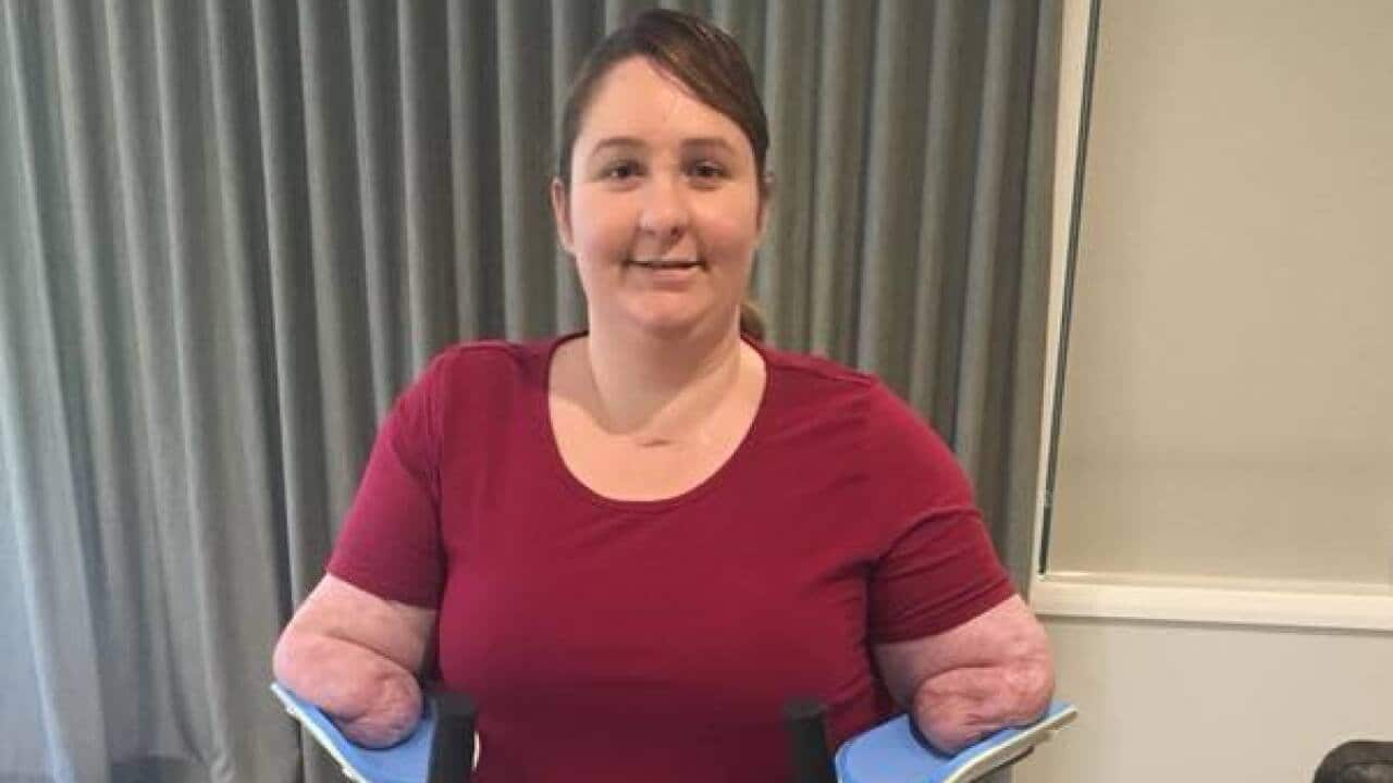 Korina Valentine adapting to live as a quad amputee after suffering from sepsis.